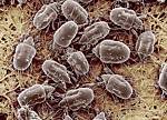 Dust mites infest a mattress